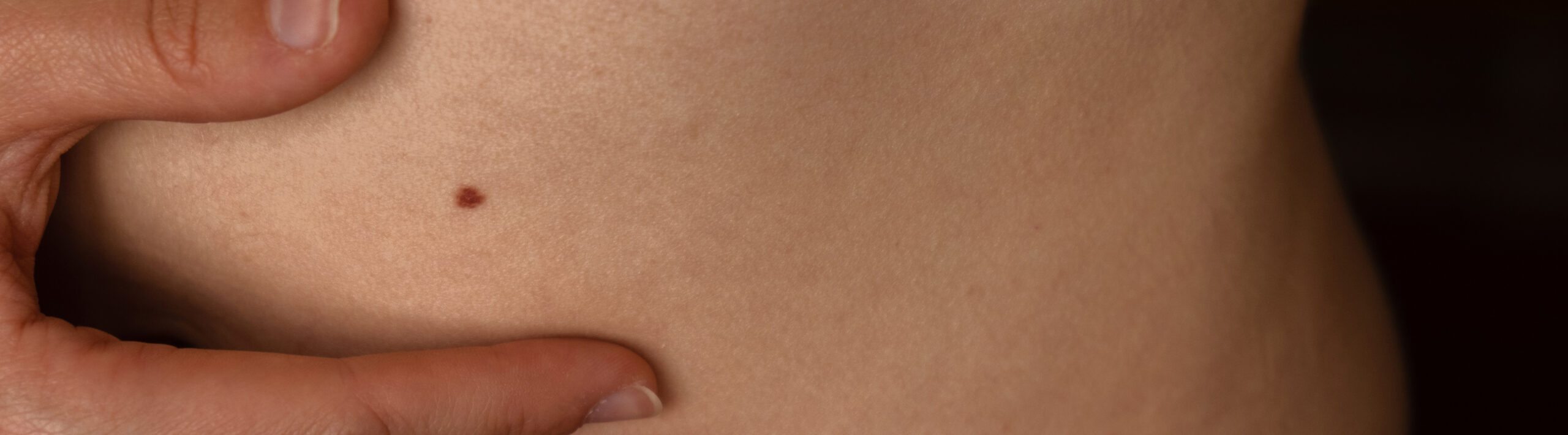 Moles