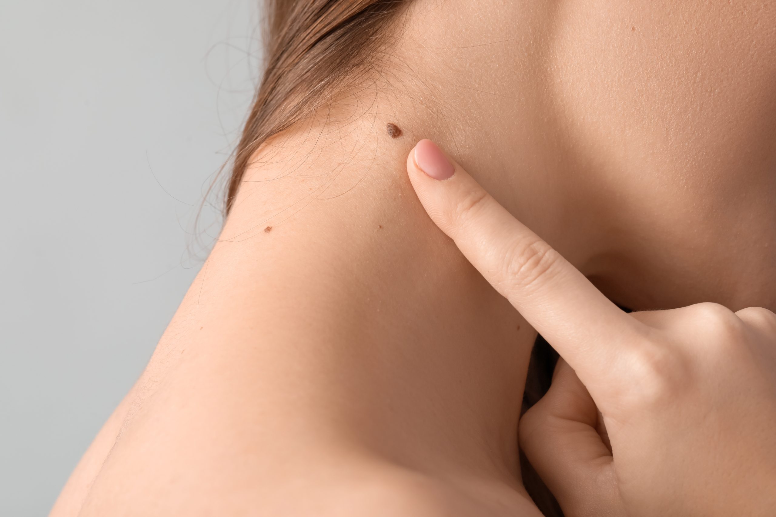 Moles